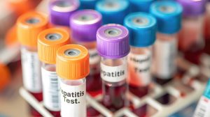 Hepatitis A test kémcsövek