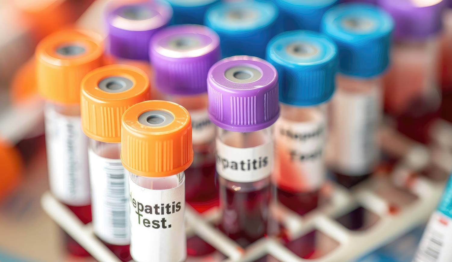Hepatitis A test kémcsövek