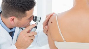Orvos vizsgálja a nő hátán lévő anyajegyet
