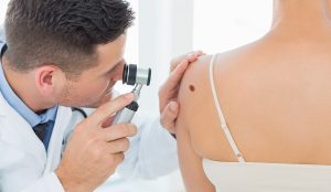 Orvos vizsgálja a nő hátán lévő anyajegyet