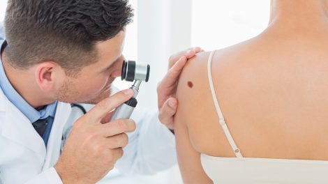 Orvos vizsgálja a nő hátán lévő anyajegyet