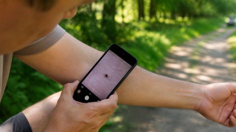 mobiltelefonnal keresi egy férfi az erdőben a kullancsot a bőrében
